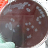 炭疽菌コロニーの写真です